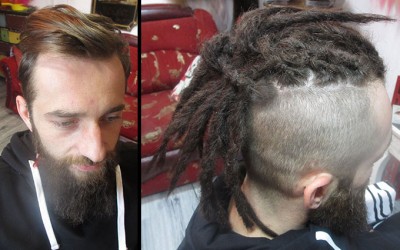 beforeafter14