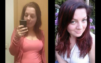 beforeafter28