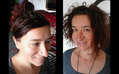 beforeafter29