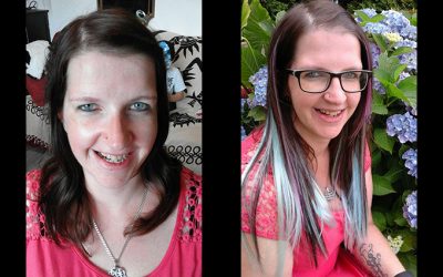beforeafter33