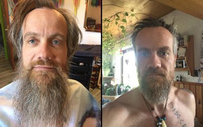 beforeafter60