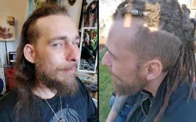 beforeafter78