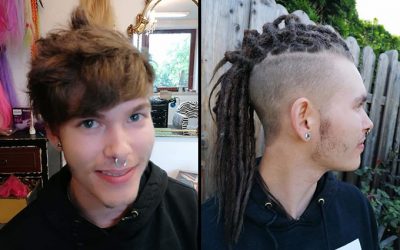 beforeafter81