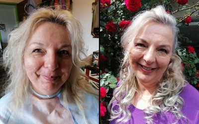 beforeafter84